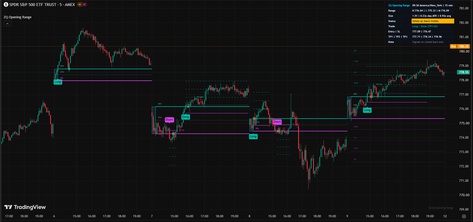 ZynIQ Opening Range Master running on a TradingView chart