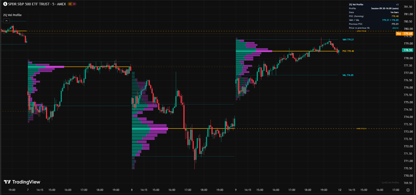 ZynIQ Volume Profile Master running on a TradingView chart